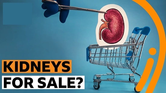 Kidney Sale