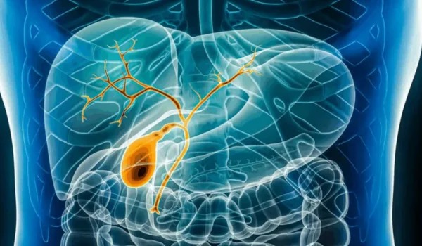 Ozempic Gallbladder Lawsuit: Gallstones, Gallbladder Disease and 2026 Lawsuit Status